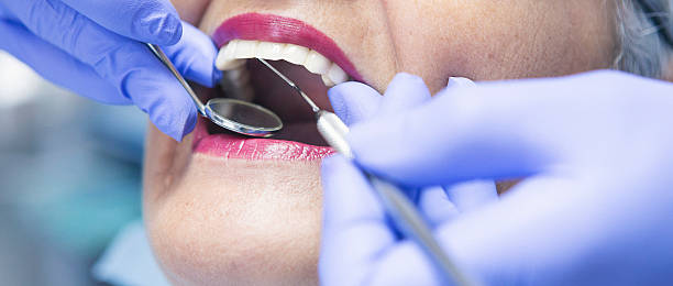 Best Emergency Dental Care for Broken or Chipped Teeth in Wyong, MI