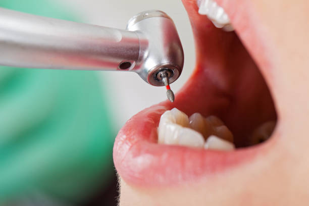 Best Cosmetic Emergency Dentistry in Wyong, MI